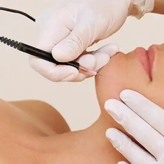Electrolysis Treatment